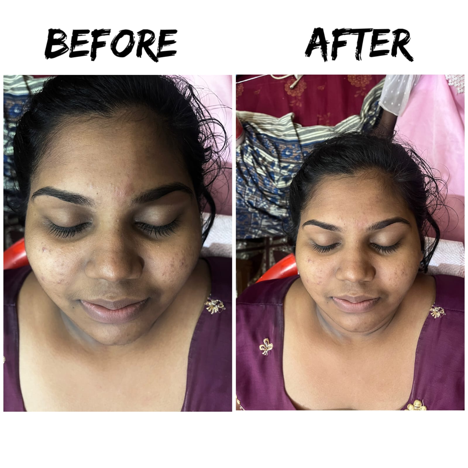 Facial Clean up